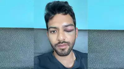 unmukt chand eye injury