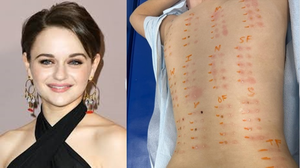 Joey King shares results of allergy test, says she's pretty much allergic to everything