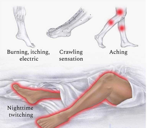 Scientists find treatment for restless leg syndrome