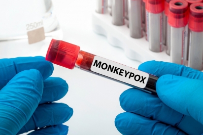 South Africa on high alert after five confirmed cases of monkeypox