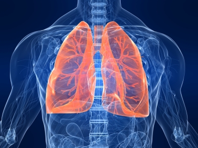 Why are most lung cancer patients in India non-smokers?