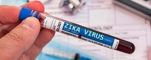 Maternal Zika infection may have long-term effects on babies' immune system