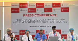 Doctors save baby born with intestines outside body in Gurugram