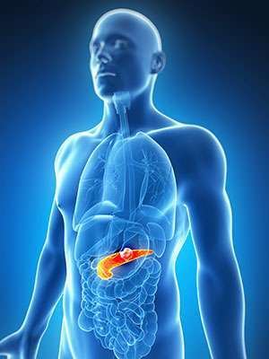 Pancreatic cancer patients may benefit from a ketogenic diet